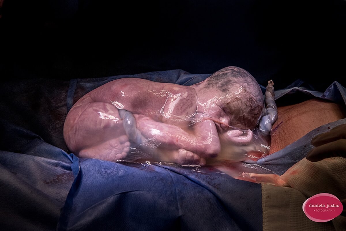 Mindblowing Images Of Childbirth From 2018 Winners Of Birth Photography Contest