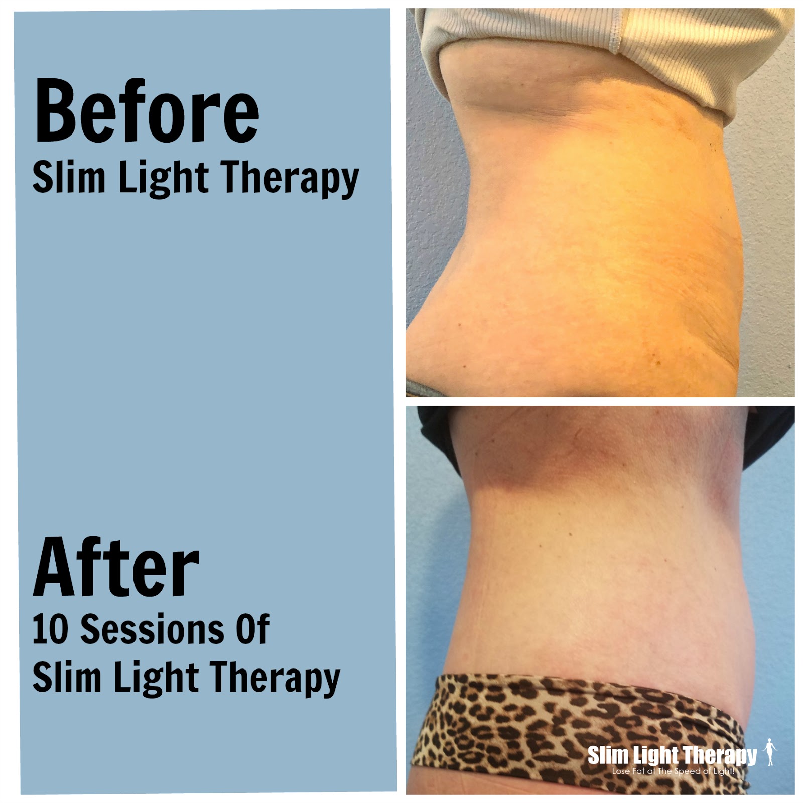 Fat burning light
