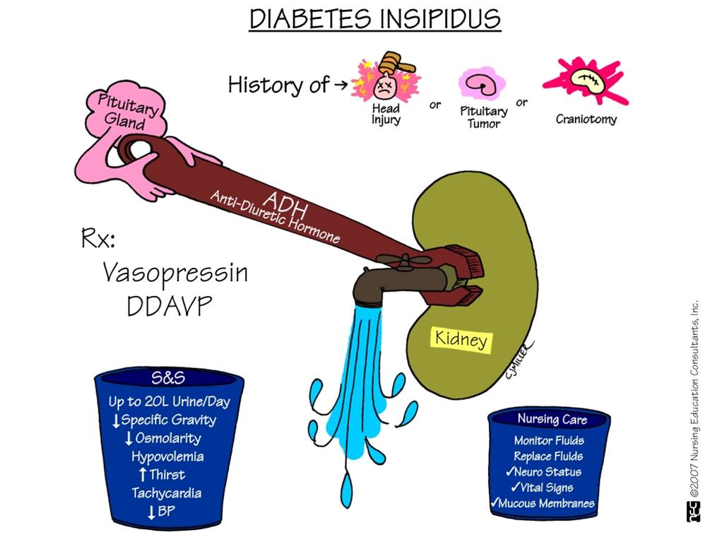 acidosis metabólica en diabetes insípida acidosis metabólica en diabetes insípida