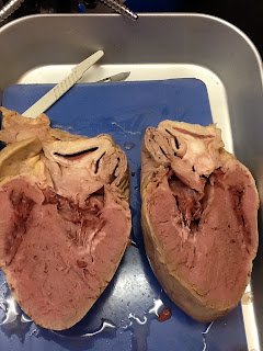 ANATOMY!!!! : ): Pig Heart Dissection!