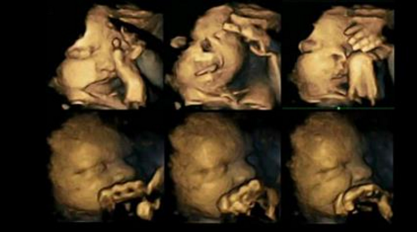 Voici la réaction d’un foetus quand sa mère fume! Les photos de l’échographie vont vous briser le coeur!
