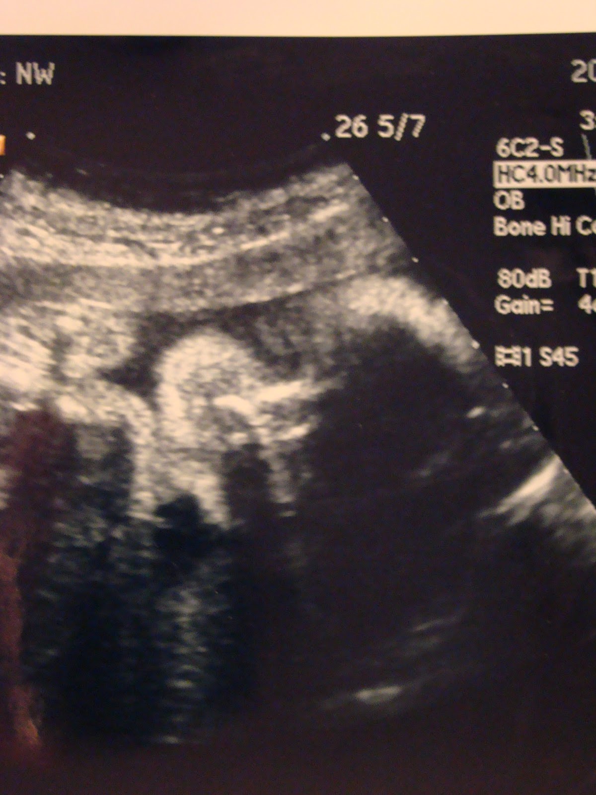 Baby Masi Our Growth Ultrasound