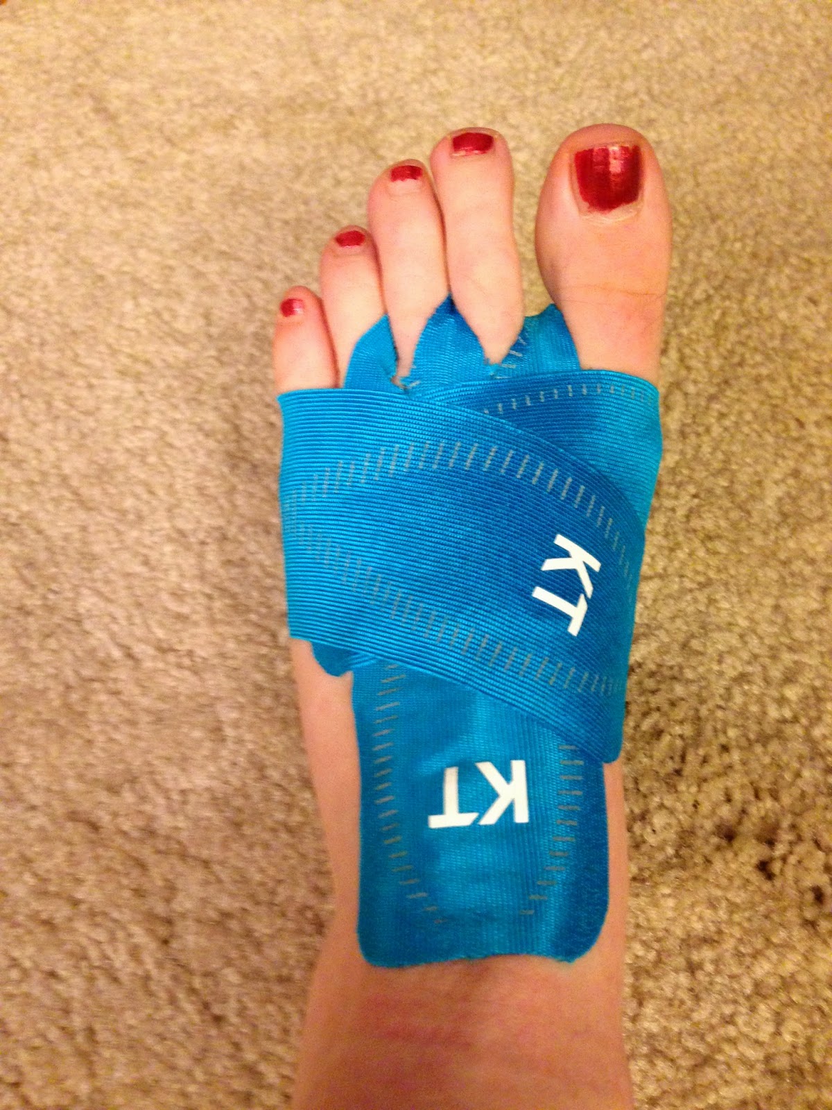 Kim Runs Miles With Smiles Conquering Neuromas pin-on-exercise-help