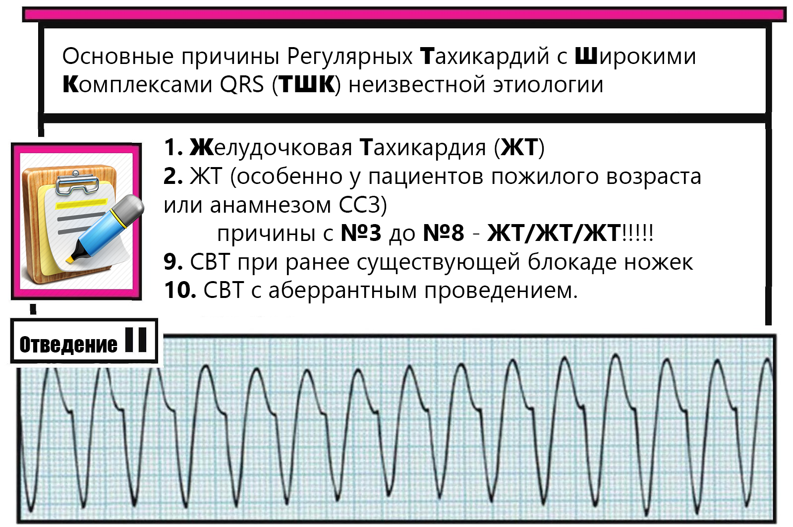 Тахикардии с широкими комплексами qrs классификация. Наджелудочковая тахикардия с широкими комплексами qrs. Тахикардия с широкими комплексами qrs дифференциальная диагностика. Тахикардия с широкими комплексами qrs. Тахикардия с широкими комплексами qrs.