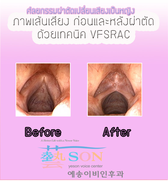 My Image 15