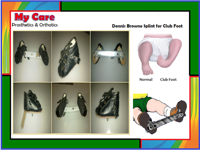 corrective shoes for toe walkers