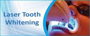 Laser Tooth Whitening Delhi India