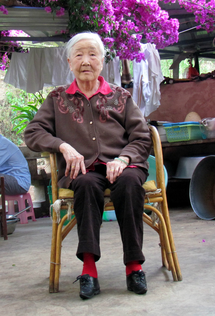 Deformutilation Chinese Foot Binding Part III