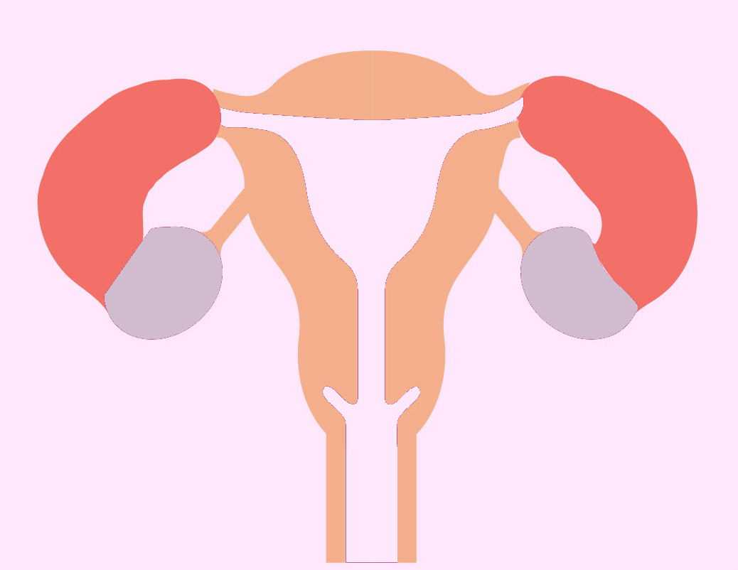 Apa Itu Hidrosalping Bagaimana Pengobatannya Bisakah Hamil