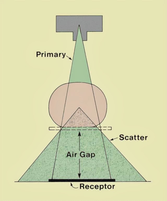 Sekelumit Radiologi AIR GAP TECHNIQUE