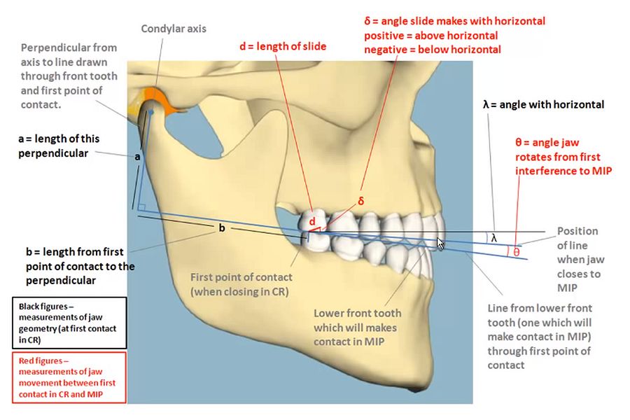 OCCLUSION Condylar Axis Movement from Centric Relation to MIP