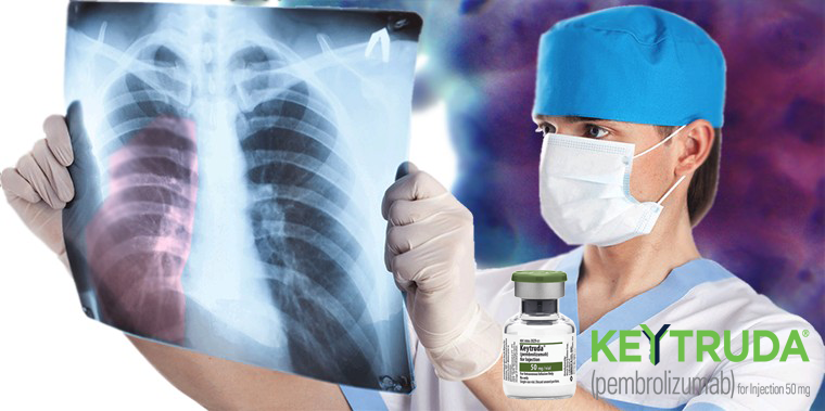 mesothelioma treatment with therapy and keytruda drugs