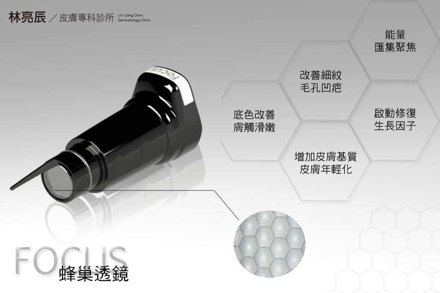 PicoSure755皮秒雷射蜂巢式聚焦陣列透鏡蜂巢透鏡皮秒雷射蜂巢皮秒雷射雀斑曬斑除斑痘疤毛孔細紋水飛梭推薦水飛梭皮膚健康管理系統新竹推薦敏弱肌雷射術後林亮辰皮膚專科診所 PicoSure755皮秒雷射蜂巢式聚焦陣列透鏡蜂巢透鏡皮秒雷射蜂巢皮秒雷射雀斑曬斑除斑痘疤毛孔細紋水飛梭推薦水飛梭皮膚健康管理系統新竹推薦敏弱肌雷射術後林亮辰皮膚專科診所