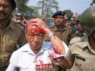 Ex-servicemen who were brutally beaten up in Darjeeling More by WB Police on 9th April 2008