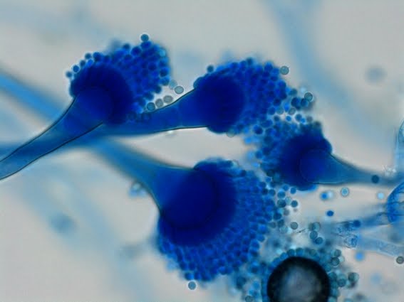 Fun With Microbiology (What's Buggin' You?): Aspergillus fumigatus
