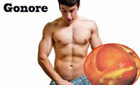 Pengidap gonorrhoeae bisa terjadi sakit nyeri saat kencing