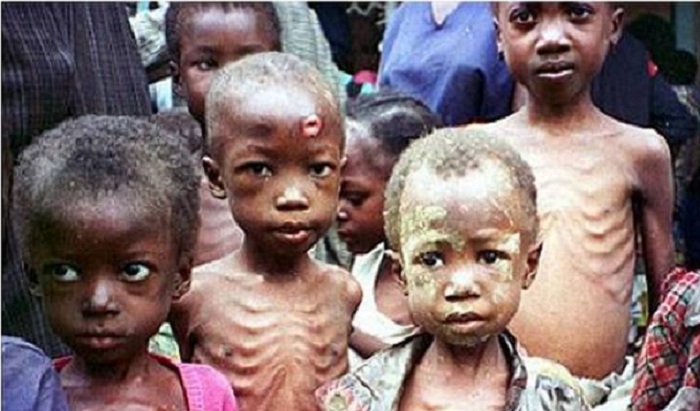 RUDI AFRIKANIS: 58 Ribu Anak Somalia Terancam Mati Kelaparan