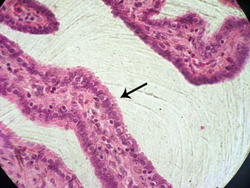 Histologia UFJF Lâmina 39 Tuba uterina