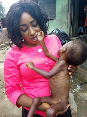 Photos: Nigerian doctor rescues severely malnourished child and her 16-year-old mother in Calabar 