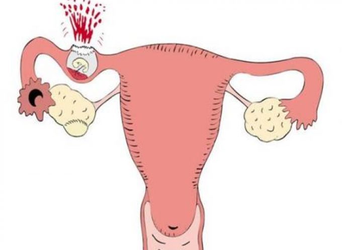 saglikla ilgili her sey dis gebelik