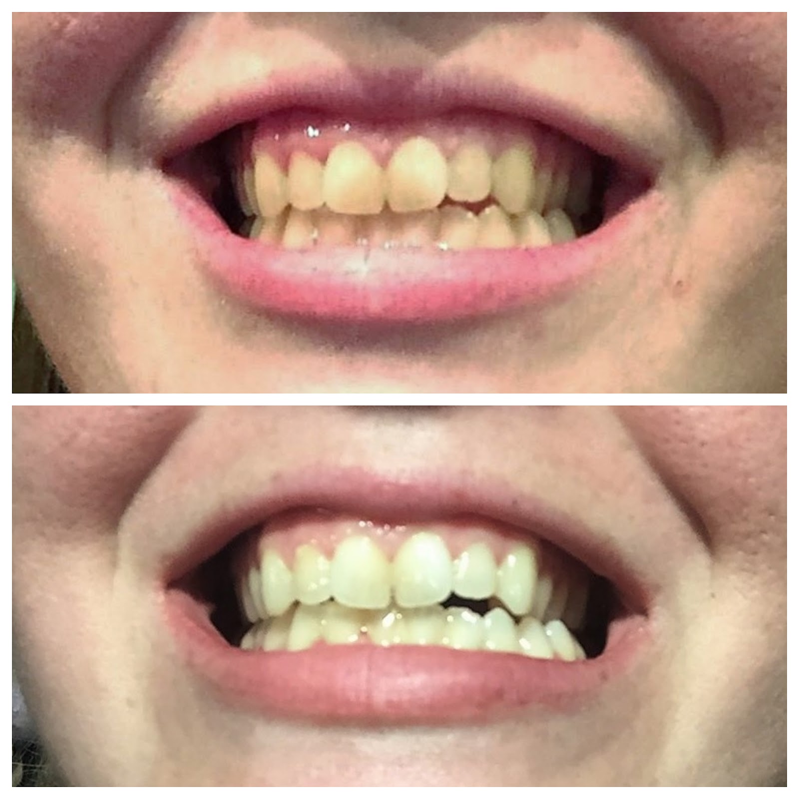 Twelve Makes a Dozen Guest Blog Smile Brilliantly by Drama Queen