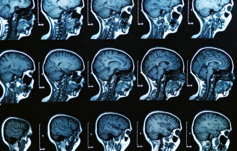 Di Che Colore E L Alluminio