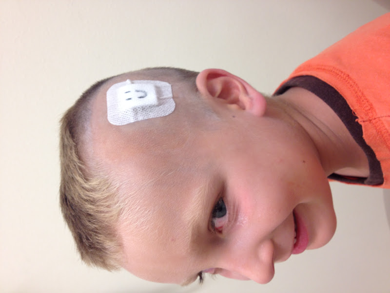 Courtright Family: Strep, Stitches, Staples, and Splinters