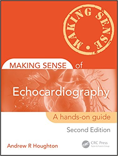 Anaesthesia Database Making Sense Of Echocardiography A