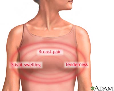 Breast Pain After Menopause Menopause Now