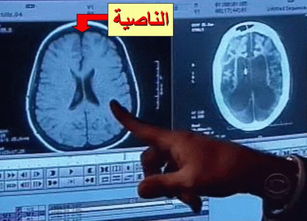 Inilah Bagian Otak Manusia yang Paling Bertanggung Jawab Atas Semua Kebohongan Inilah Bagian Otak Manusia yang Paling Bertanggung Jawab Atas Semua Kebohongan
