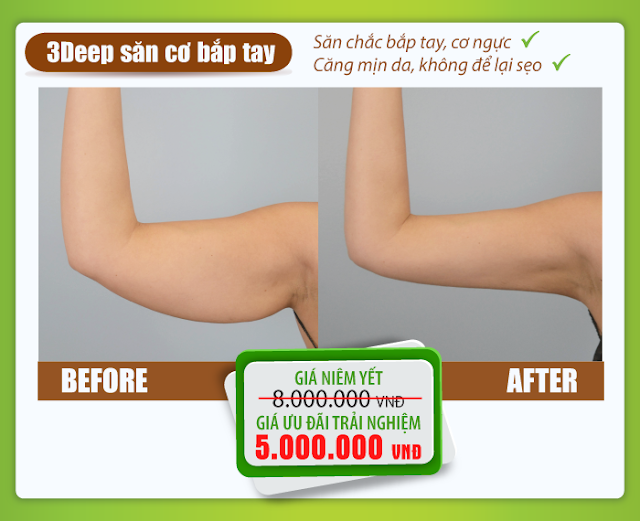 3Deep săn cơ bắp tay 3Deep săn cơ bắp tay
