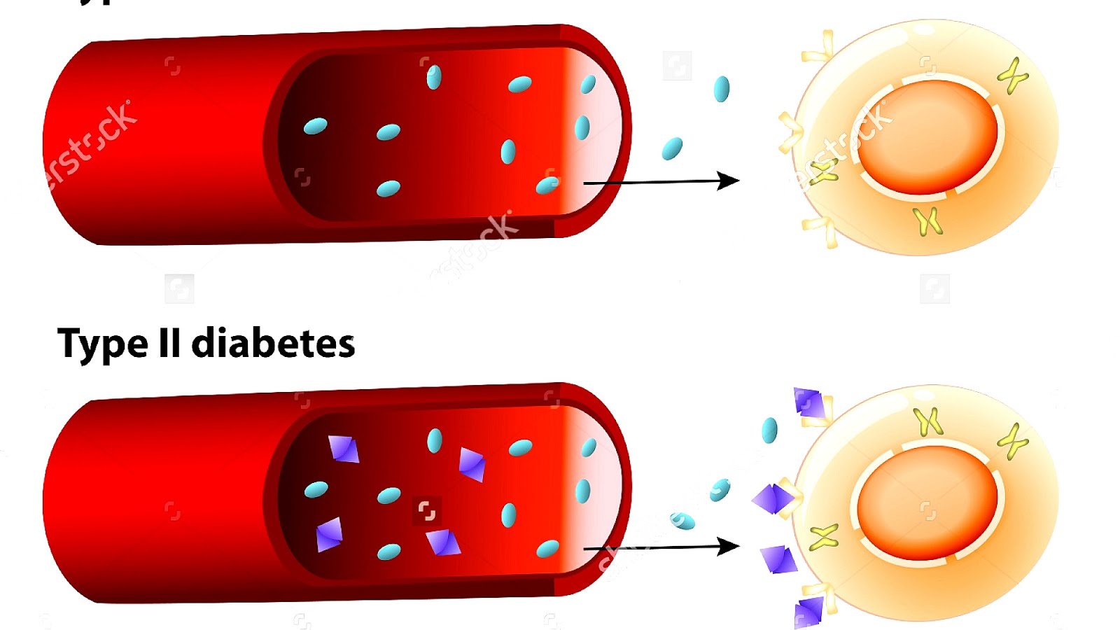 Is Type 2 Diabetes Insulin Dependent - Insulin Choices