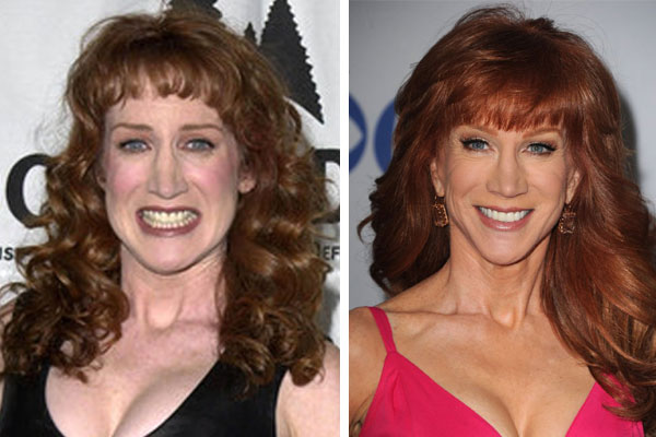 Griffin fappening kathy Celebrities who