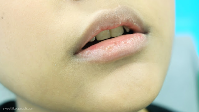 Tips Mengatasi Bibir Kering Dalam Sekejap