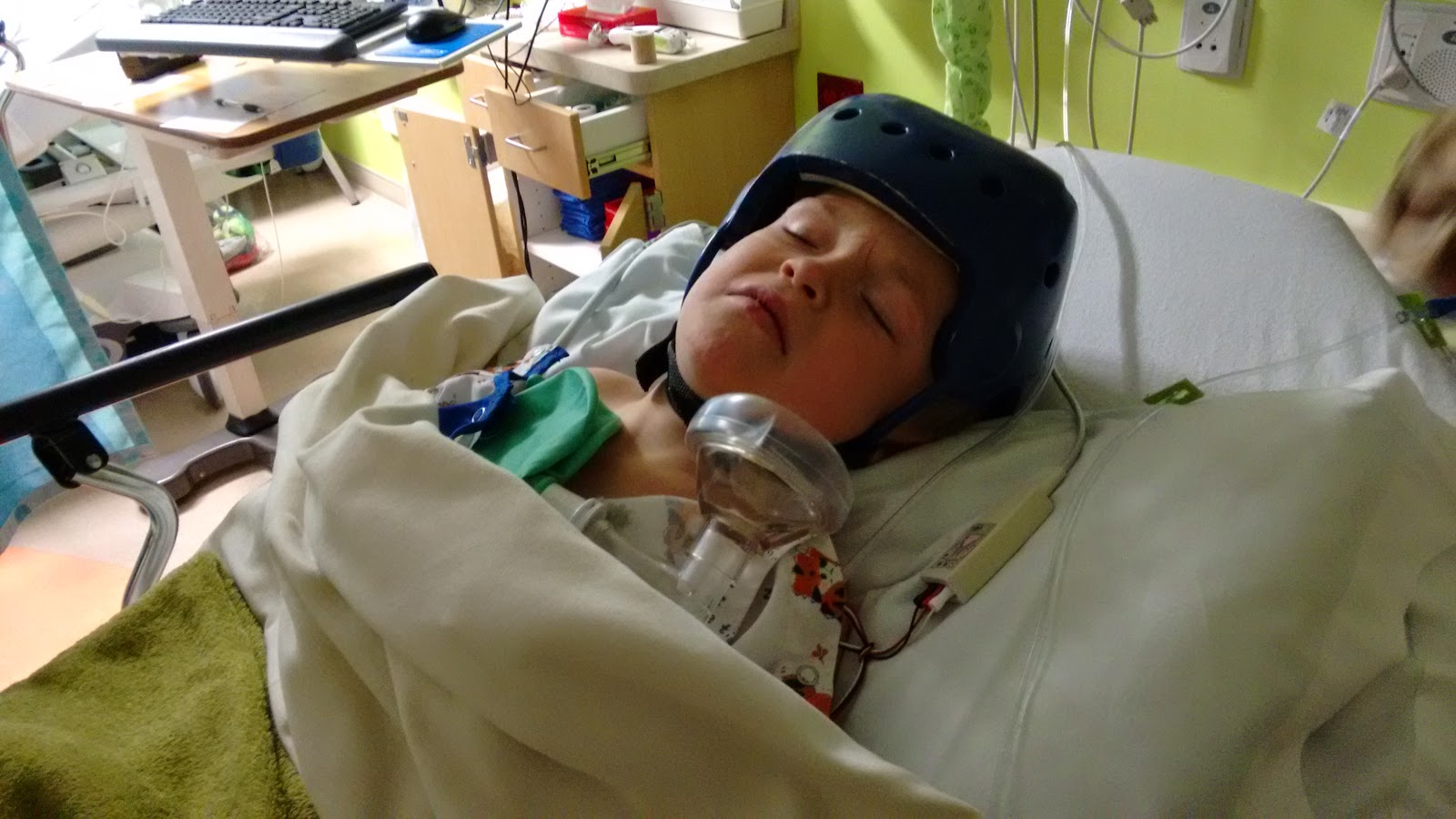 Gm1 Gangliosidosis Type 2 Our Experience Eli's Gtube Surgery