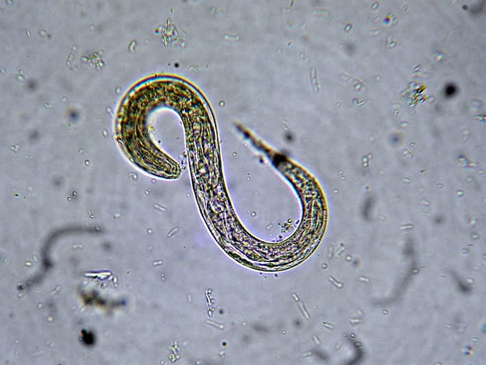 Strongyloides stercoralis