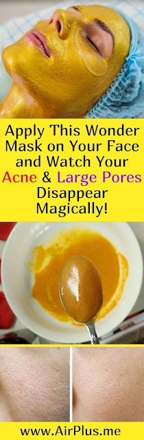 Apply This Wonder Mask on Your Face and Watch Your Acne & Large Pores Disappear Magically!