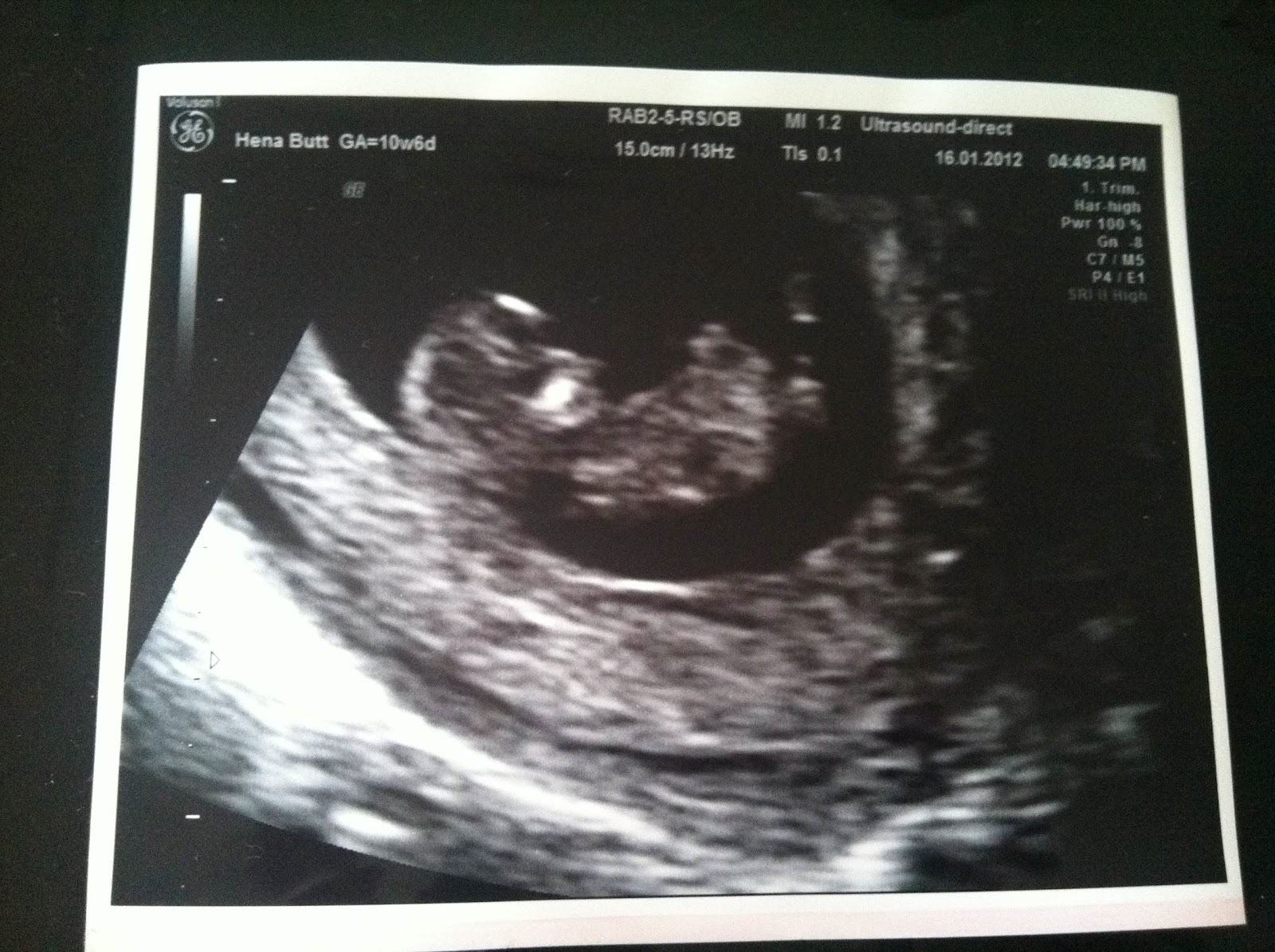 My First Baby Baby s First Scan Picture My First Baby Baby s First Scan Picture