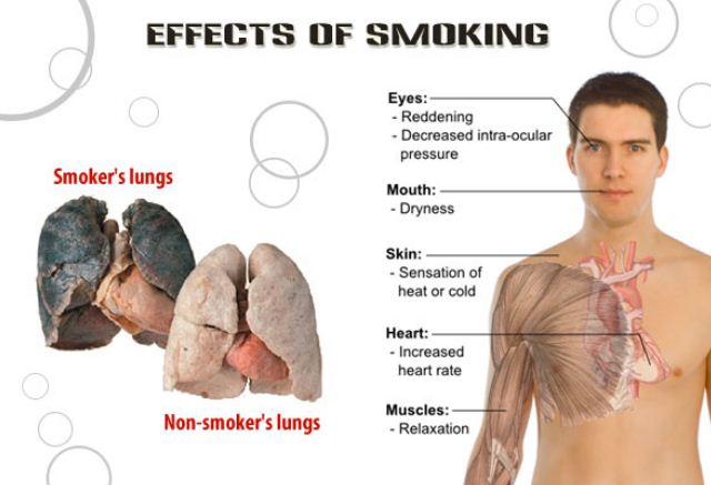 Smoking Is Injurious To Health Everyday Life