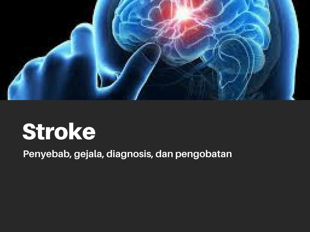 Stroke: Penyebab, gejala, diagnosis, dan pengobatan