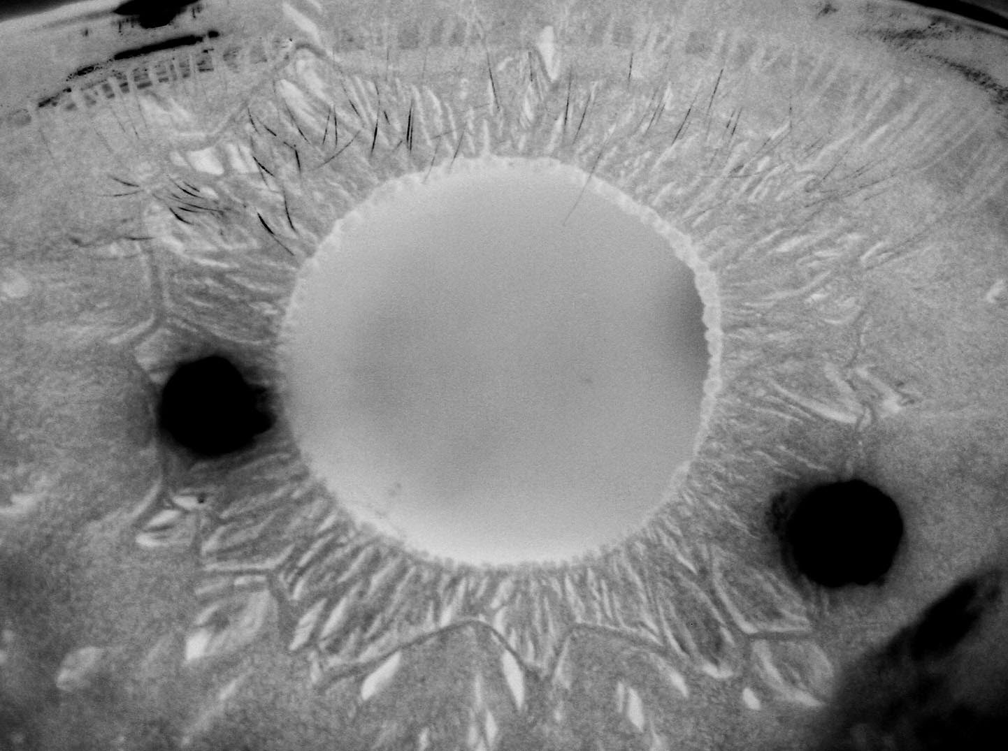 Modern & Multidimensional Iridology Lacunae & Crypts at the Internal