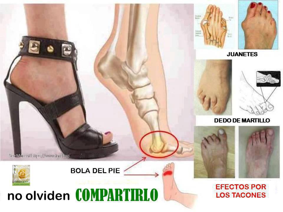 Porque No es Usar Tacón Alto Protege tu Salud Porque No es Usar Tacón Alto Protege tu Salud