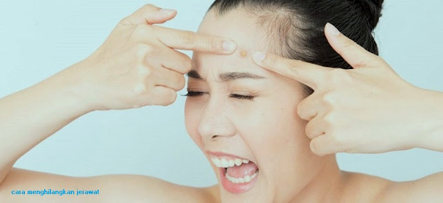 cara menghilangkan jerawat secara alami gambar cara menghilangkan jerawat secara alami