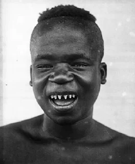 Ota Benga was just 5ft tall. An American missionary, Samuel Philips Verner, bought the 103 pounds, dark skin, with artificially sharpened teeth for exhibition slavery.