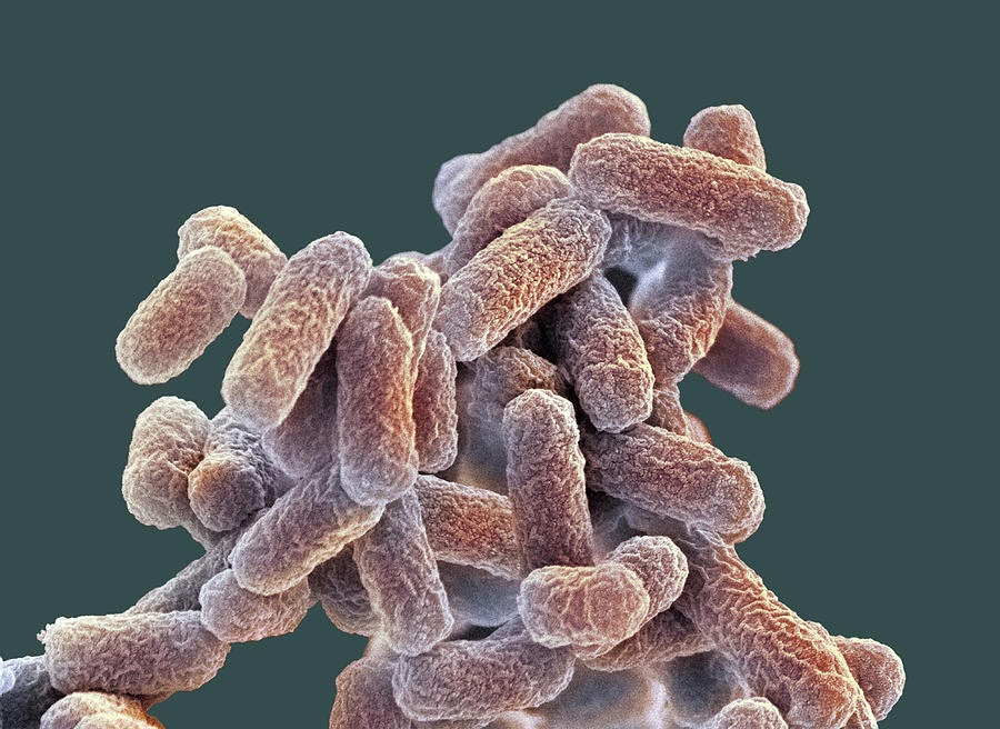Can E Coli Be Seen Without A Microscope at Richard Adler blog