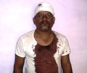 Hindu Extremists attacked Lal Mani Prasad