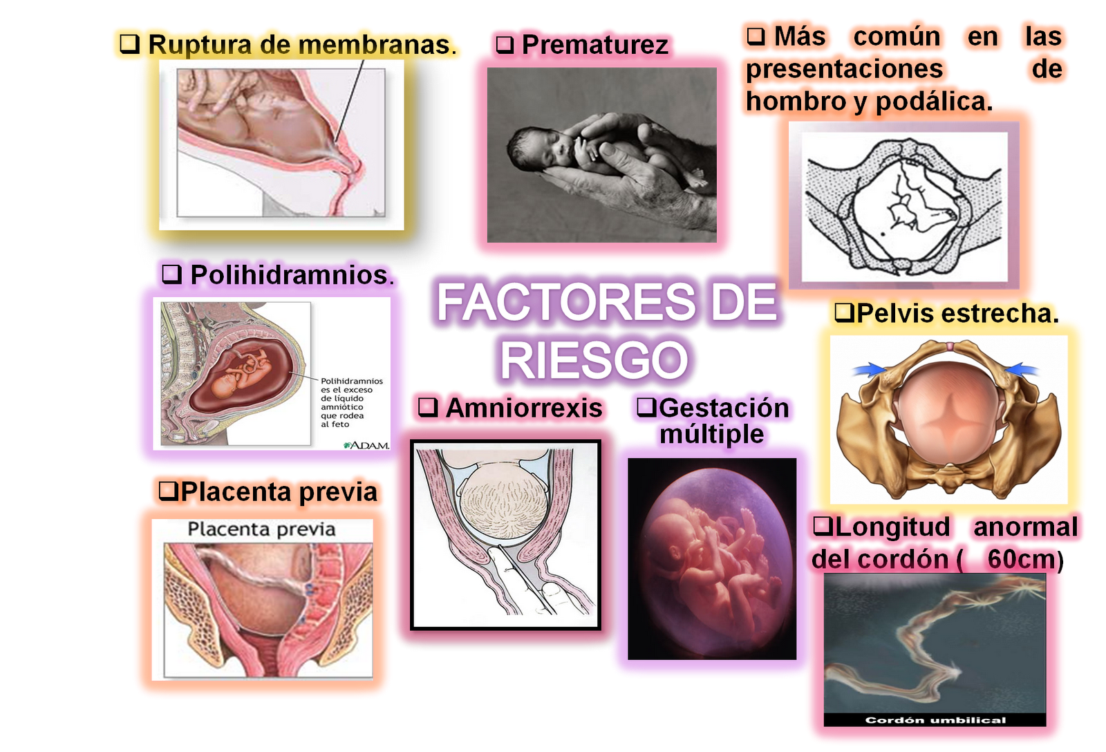 PROLAPSO DE CORDÓN "Obstetricia I"