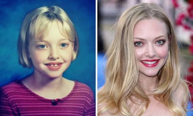 O antes e o depois da carreira das belas atrizes da TV e do cinema