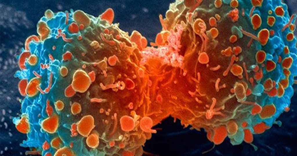 What Is Cancer? - Care Online