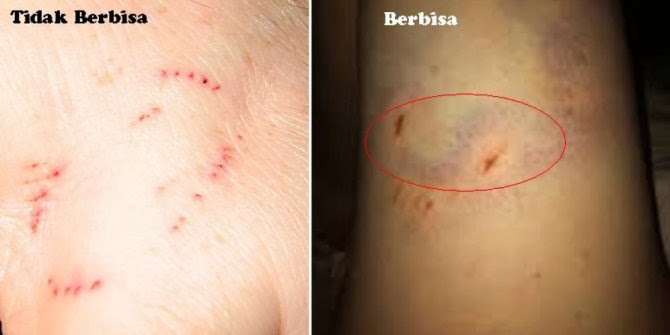 5 Cara Mengetahui Ular Berbisa Atau Tidak - airport.id